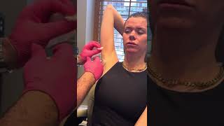 Dr. Doherty –  Underarm Botox to Reduce Sweating
