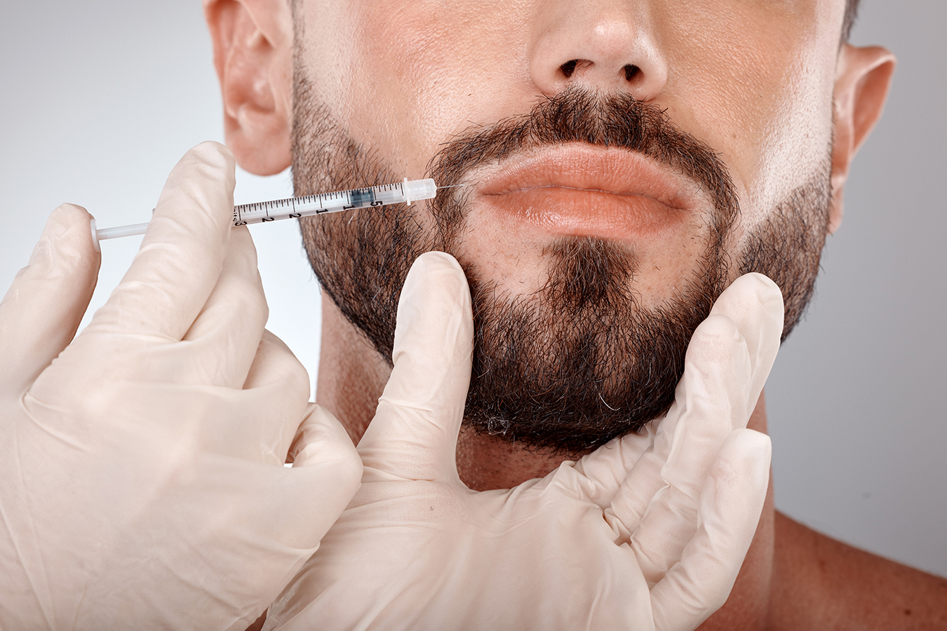 Man receiving Botox treatment around the mouth area for a refreshed, anti-aging appearance.