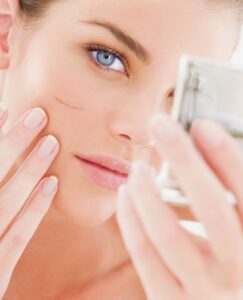 Scar Treatments That Restore Your Complexion