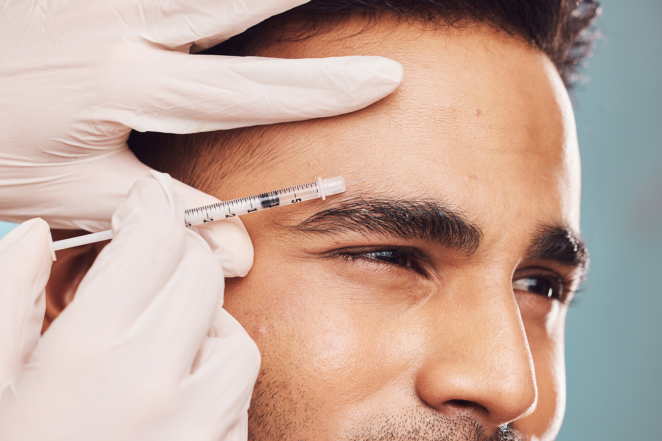 Man receiving Botox near the eyebrow area for crow’s feet and eye wrinkle reduction.