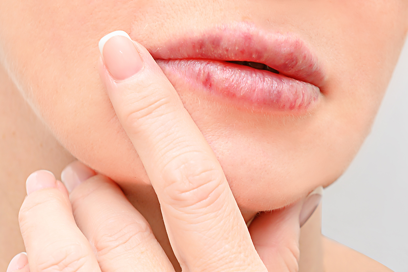 Close-up of lips representing natural lip augmentation with subtle, balanced volume.