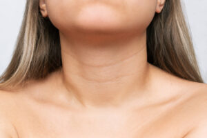 Close-up of neck lines representing treatment options for neck bands and necklace lines.