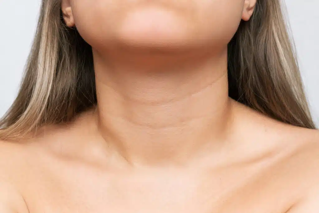 Dr. Doherty offers different cosmetic treatments to remove these annoying lines and bands from the neck skin