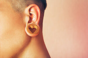 Stretched earlobe with gauge jewelry representing gauge piercing removal and earlobe repair.