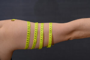 Upper arm with measuring tape representing cosmetic surgery for arm contouring, fat reduction, and smoother shape.