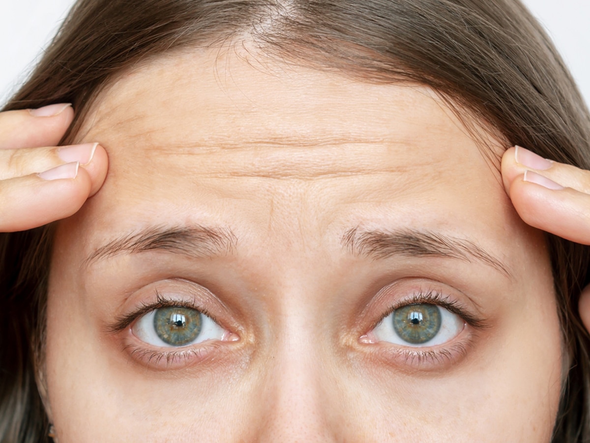 Raise Your Eyebrows With Botox Boston Ma Dr Doherty Raise Your Eyebrows With Botox Boston Ma Dr Doherty