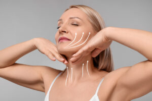 Woman with facial lift arrows for Voluma injections and non-surgical facelift information