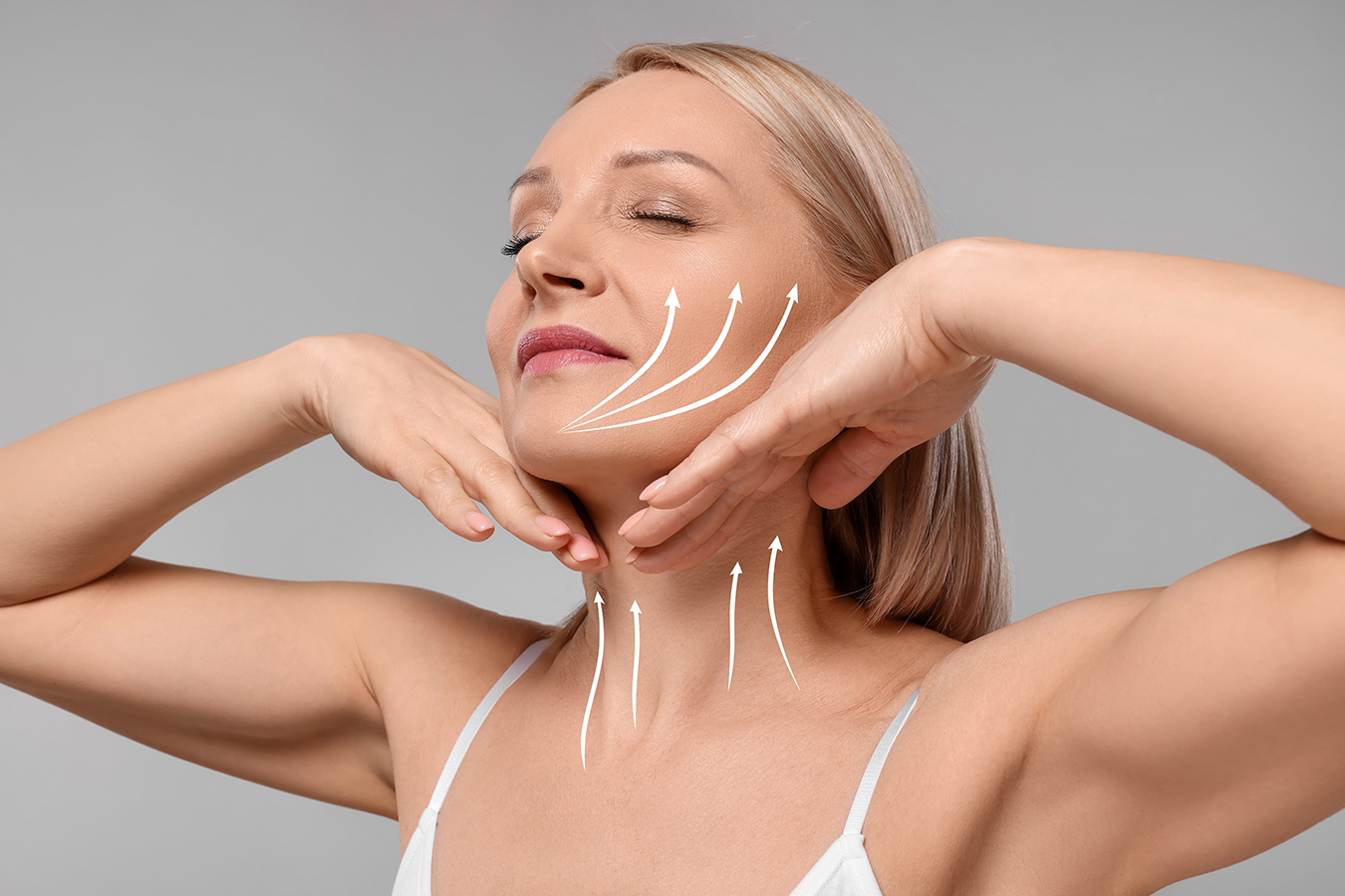 Woman with facial lift arrows for Voluma injections and non-surgical facelift information