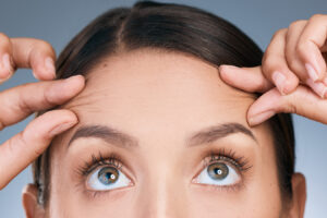 Woman pointing to forehead lines, representing Baby Botox treatment for smoother skin.