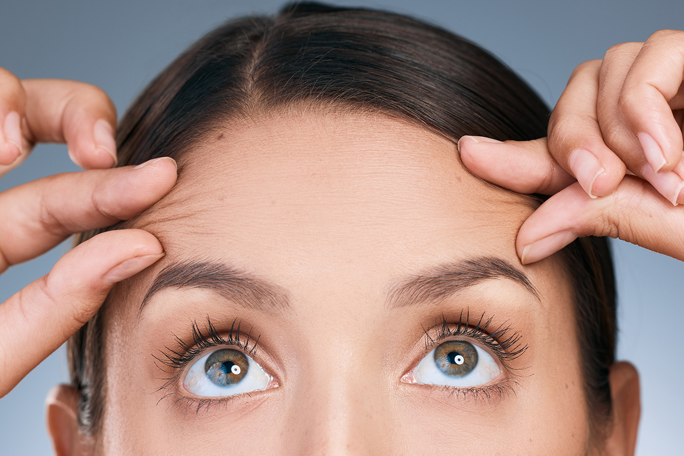 Woman pointing to forehead lines, representing Baby Botox treatment for smoother skin.