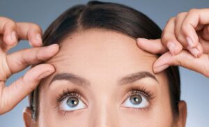 Can My Forehead Lines Be Erased?