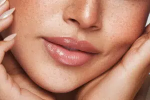 Close-up of lips for Juvederm Volbella and lip wrinkle treatment