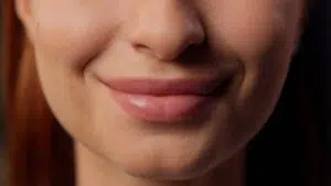 Are You Afraid of Lip Fillers?