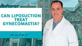 Dr. Doherty on Liposuction for Treating Gynecomastia