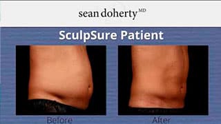 Melt Fat Away With SculpSure, No Surgery Required