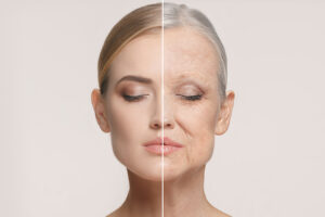 Split-face comparison showing smoother, younger-looking skin after laser skin resurfacing treatment.