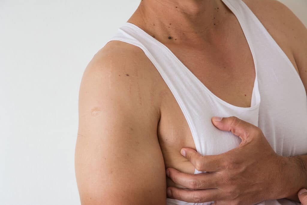 To treat this common condition in men, Dr. Doherty, a gynecomastia surgeon, provides pricing that is clear and truthful.