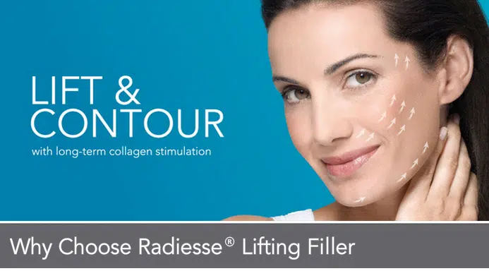 Radiesse® is also what is known as a collagen stimulator. This means that it encourages your own body to produce more collagen. Dr, Sean Doherty | Boston, MA.
