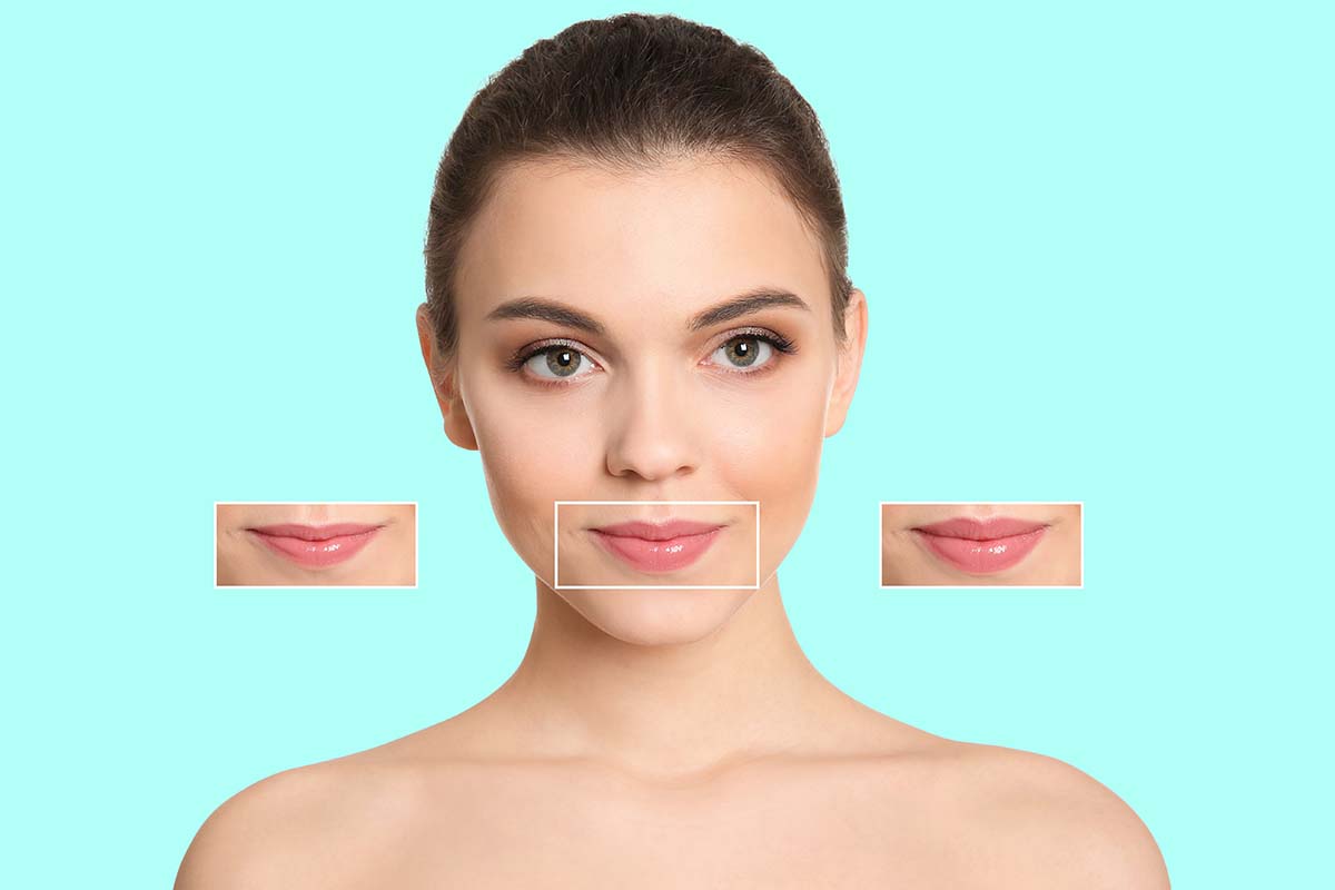 Today, there are even fillers, such as the new, cutting-edge Restylane® KYSSE, that are specifically designed for natural looking lips.