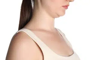 How Much Should Neck Liposuction Cost?