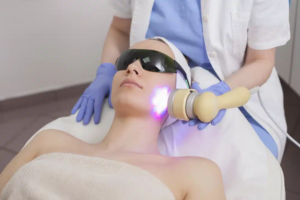 Often referred to as a photo facial, IPL is not actually a laser. It is an energy-based treatment.