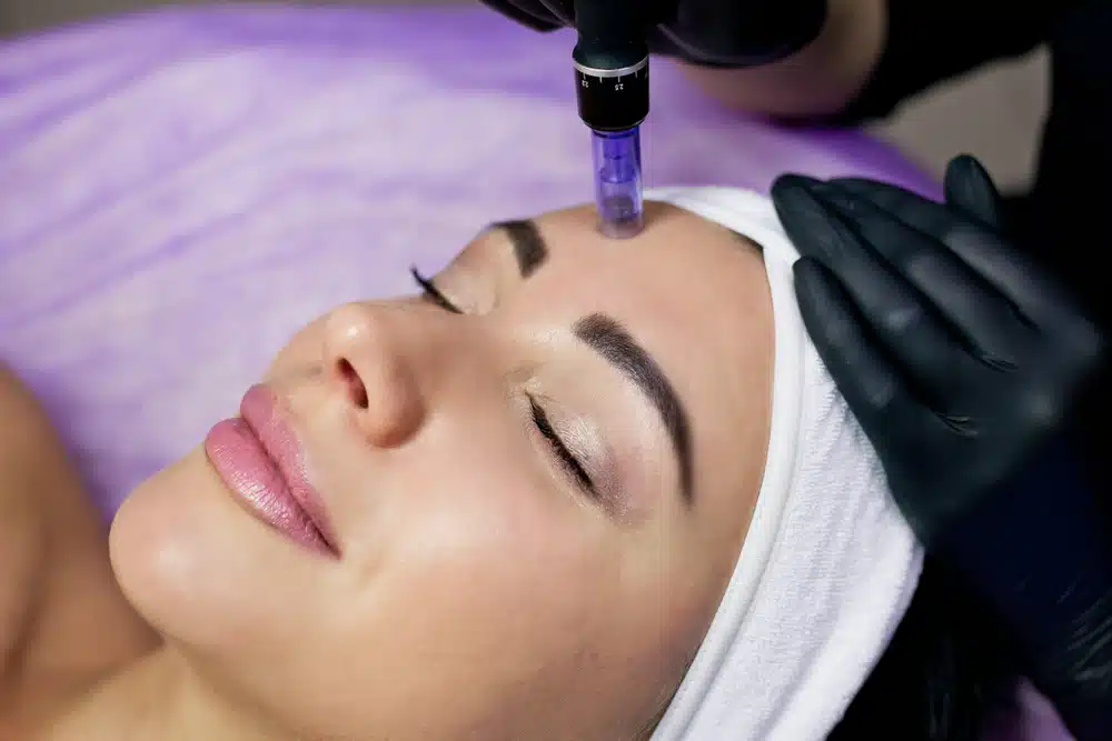 Another very effective procedure for improving both skin texture and tone is Profound.