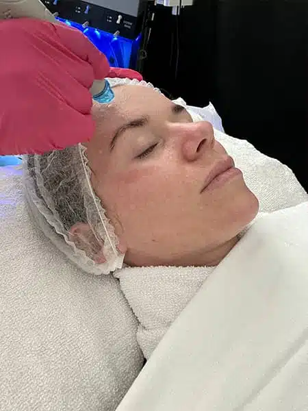 HydraFacial® is a hydradermabrasion procedure that combines the benefits of a chemical peel with intense hydration.