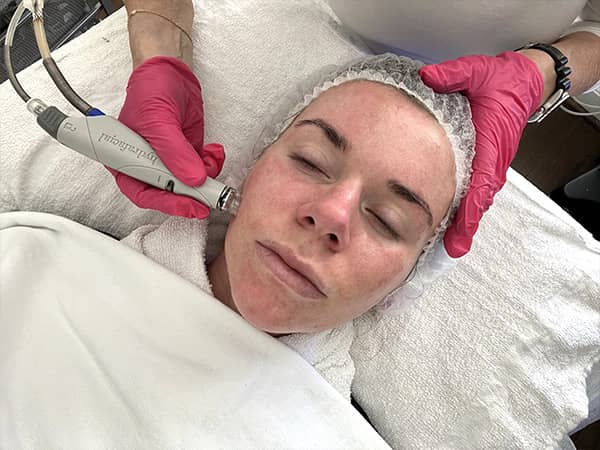 The great thing about a HydraFacial® procedure is that it can deliver all of its smoothing and plumping benefits.