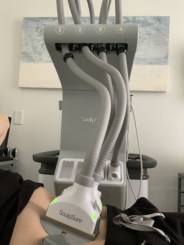 SculpSure Consultation