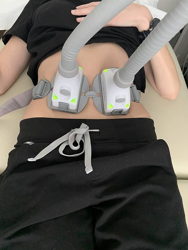 SculpSure Procedure