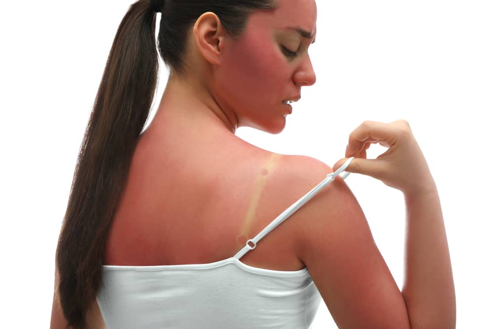 It is estimated that 90% of skin aging is the direct result of sun exposure.
