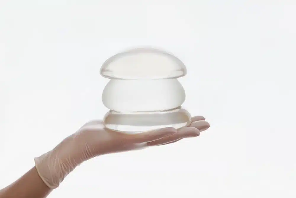 What is the cost of a breast implant exchange?