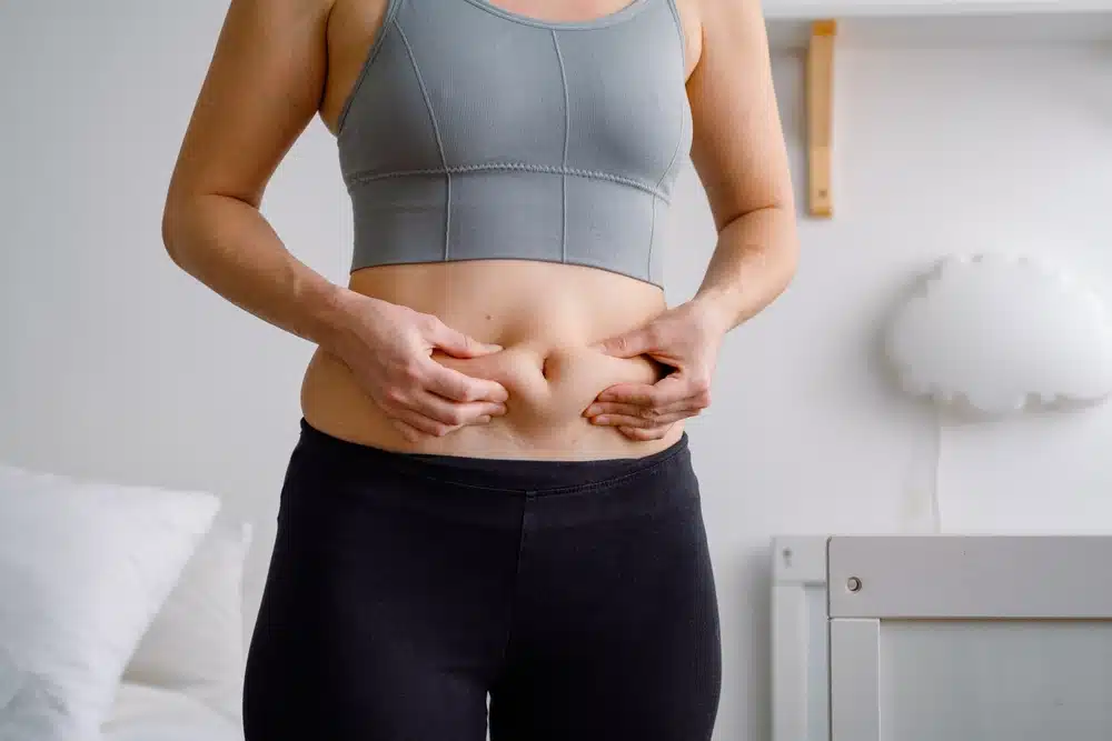  Woman pinching belly fat while considering body contouring options.