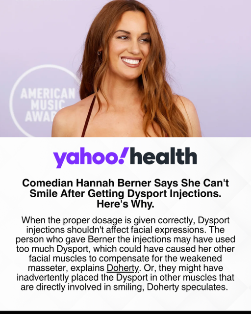 Comedian Hannah Berner says she can't smile after getting Dysport injections. Here's why.