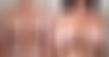 Breast Augmentation Before and After Photos in Boston, MA, Patient 2410